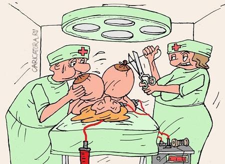 карикатура про операцию