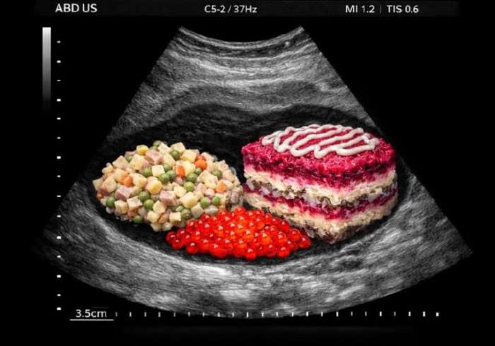 смешная картинка про узи живота